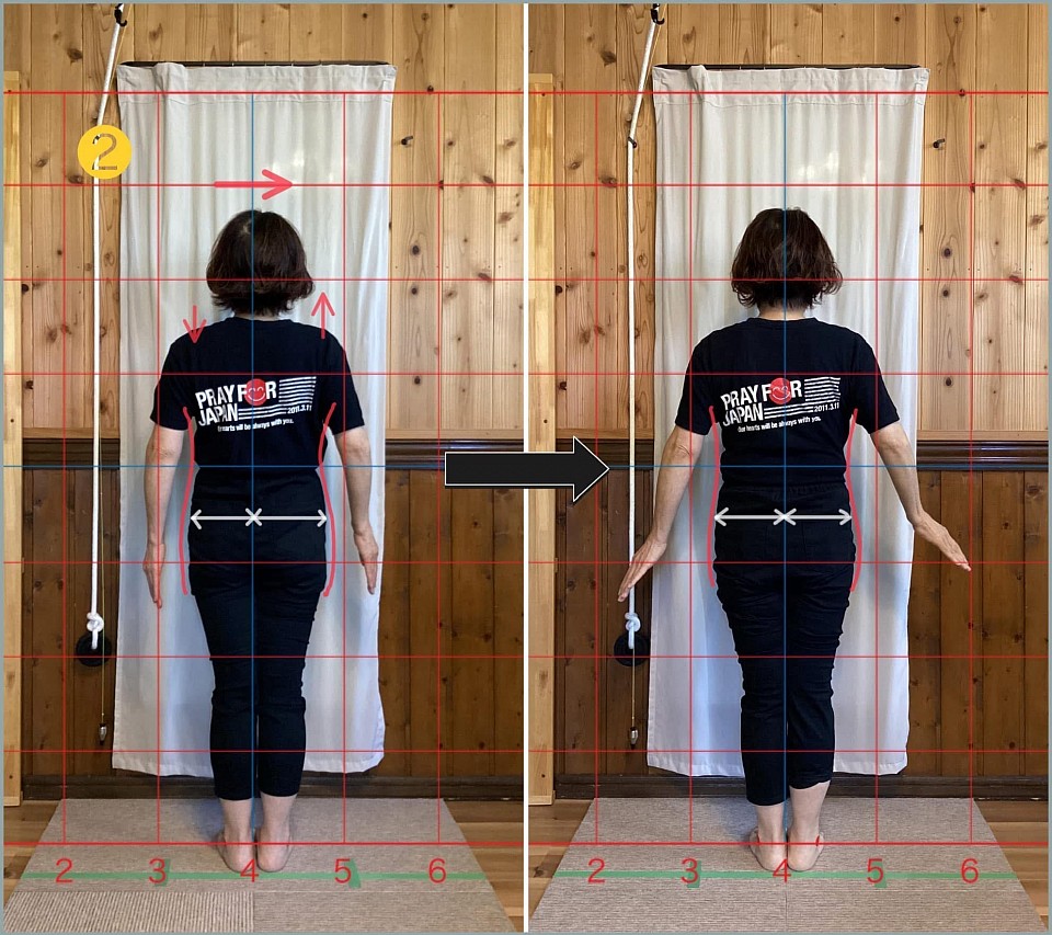 2. ビフォーアフター写真（背面）：くびれの明確化およびお尻の幅の変化が確認できます。