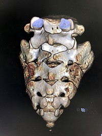 Snapmart（スナップマート）から購入した仙骨の画像です。