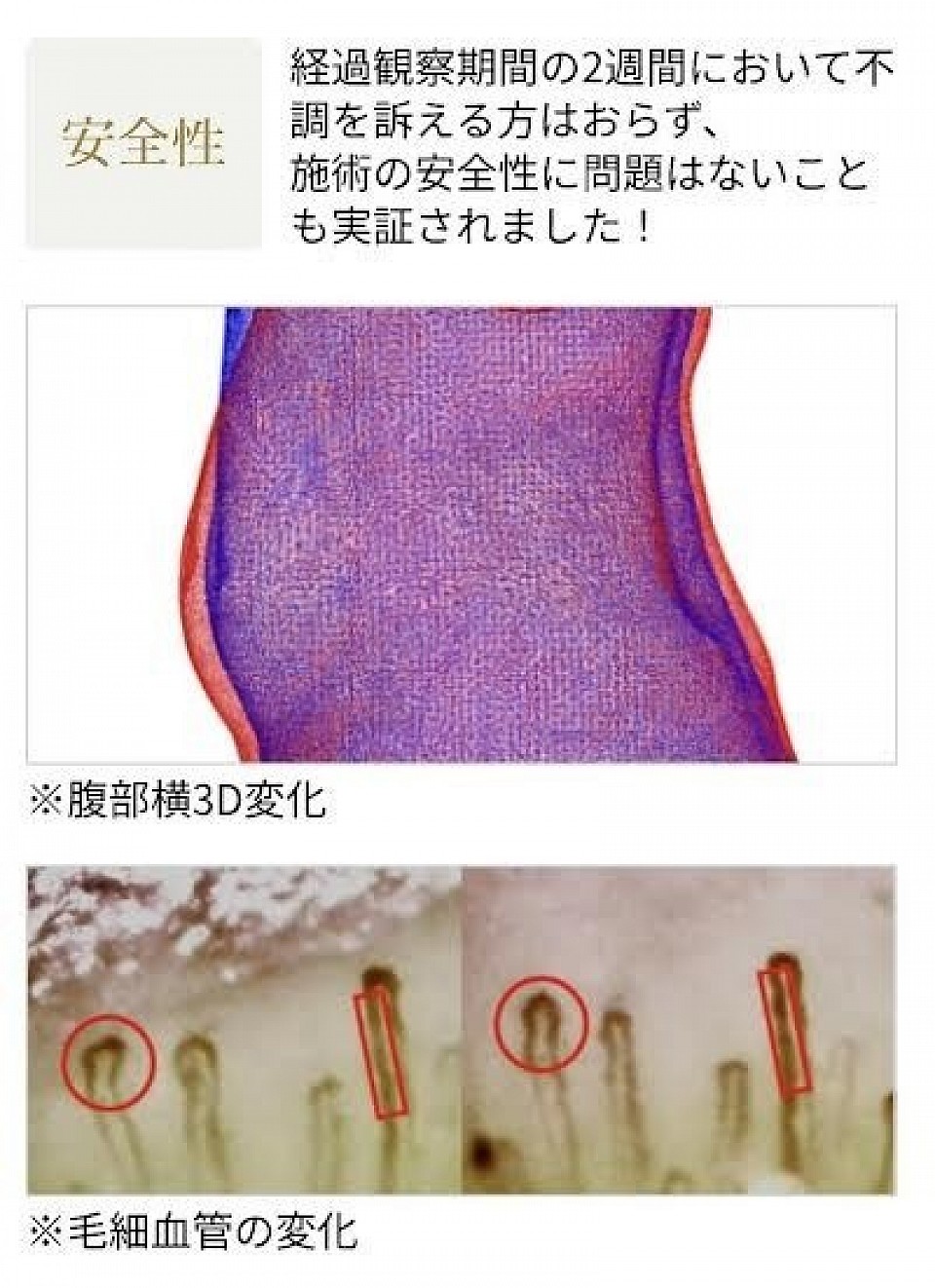 経過観察期間の2週間において不調を訴える方はおらず、施術の安全性に問題はないことも実証されました！