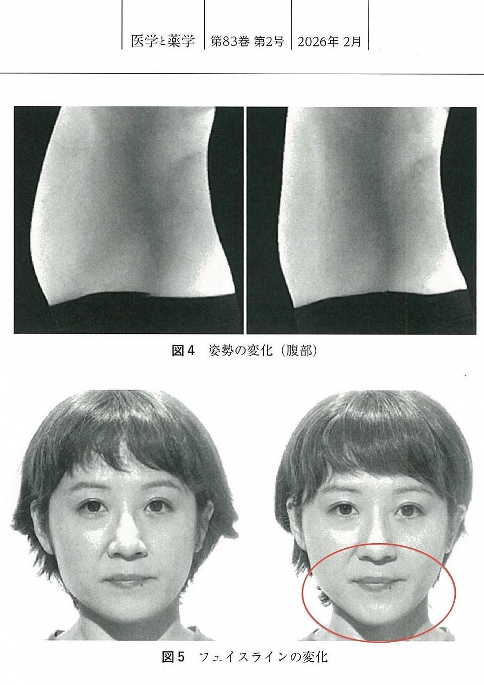 顔の小ささを実感された方は、実に100％にのぼります。