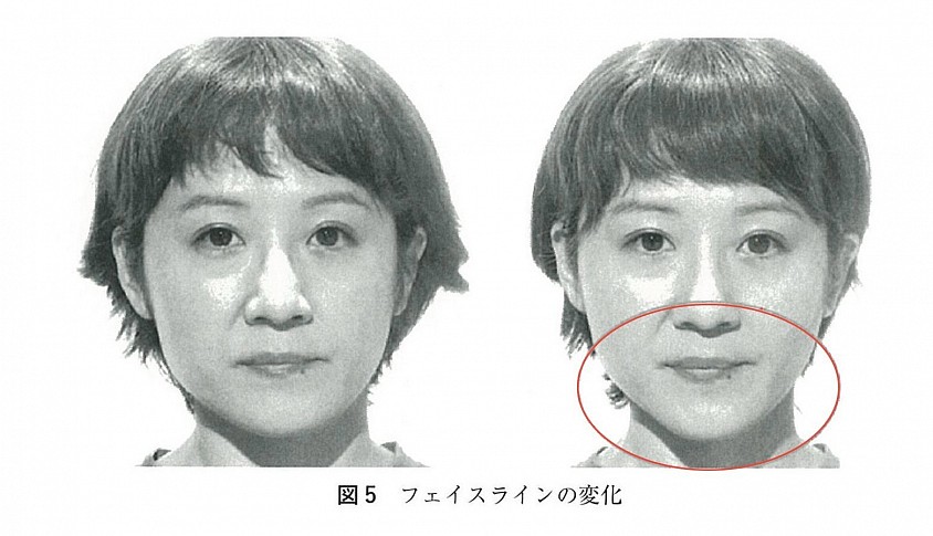 あ